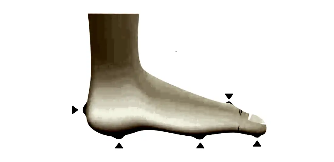 Ayak Nasırına Ne İyi Gelir