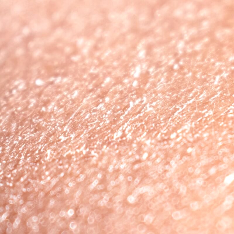 Cilt Kuruluğu İçin Yoğun Terapi: Hint Yağı ve Doğal Çözümler