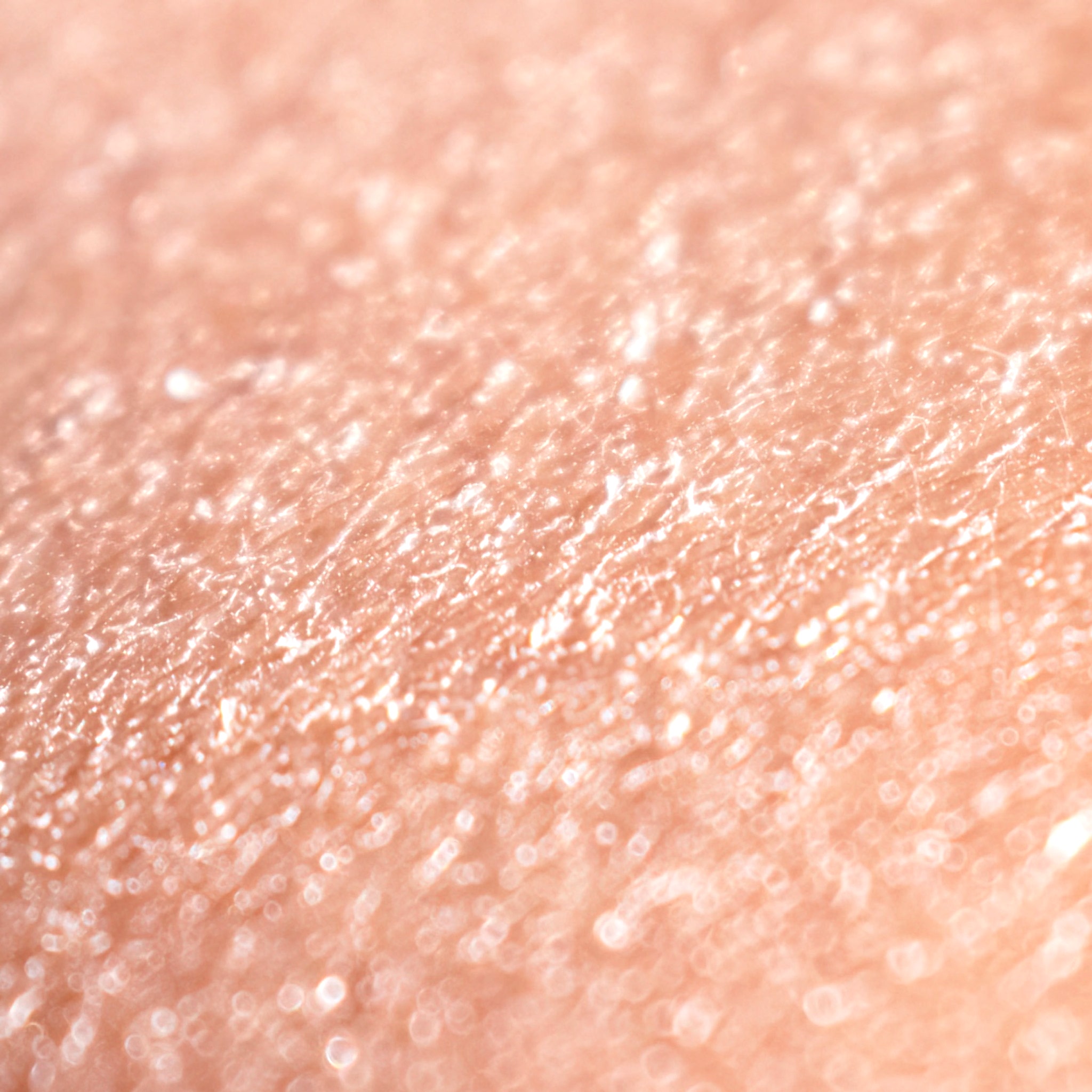 Cilt Kuruluğu İçin Yoğun Terapi: Hint Yağı ve Doğal Çözümler